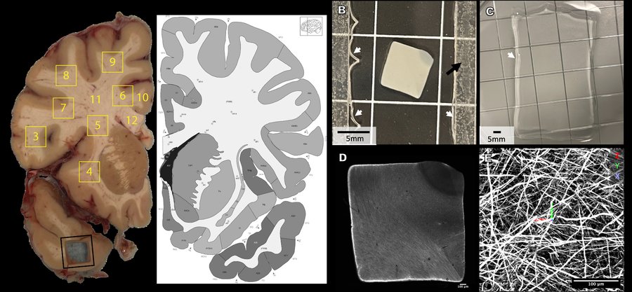 Figure 1: Brain slab, punchout locations, cleared tissue, and lightsheet image