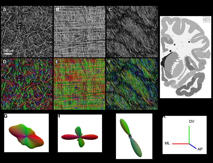 Figure 2: Three architectural motifs of human white matter with structure tensor color maps