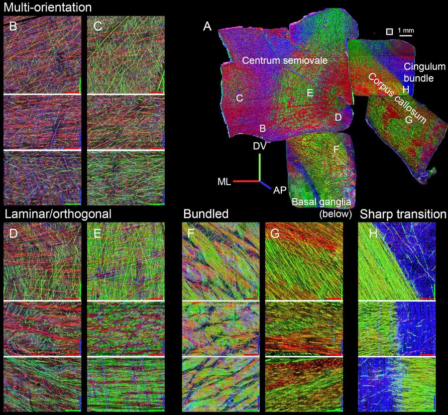 Figure 3: Full montage of four central punchouts with color-coded axon orientations